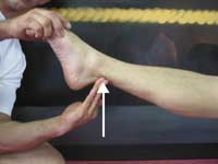 Ankle Lock Achilles Compression