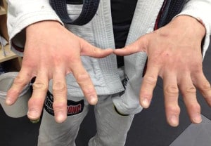 Hand and finger pain in BJJ
